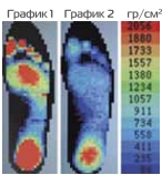 Графики распределения нагрузки обуви терапевтической Сурсил-орто / Sursil-ortho, для разгрузки переднего отдела стопы, клиновидная подошва,M, 09-101M