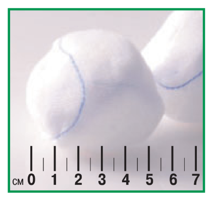 Шарики-тампоны марлевые Setpack (Сетпак) стерильные с рентгеноконтрастной нитью, размер экстра большие, 20шт, 22810