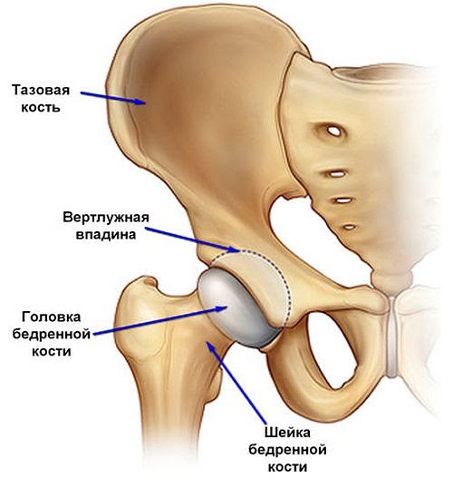 Ортез при переломе бедренной кости