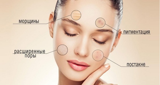 Микродермабразия алмазная Gezatone Микродермабразия алмазная Gezatone