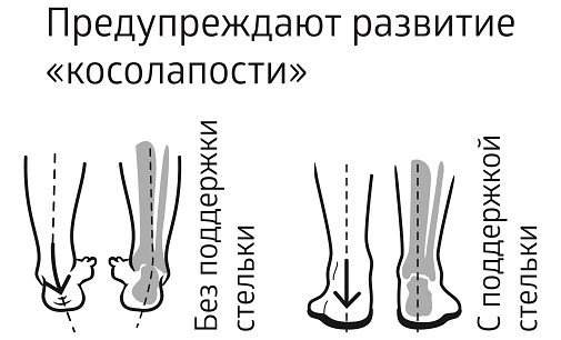 Действие полустелек ортопедических B.Well Rehab Duo kids / Би.Велл Рехаб Дуо кидс, для детей.