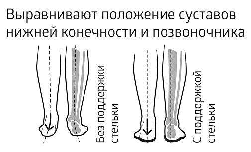 Действие стелек ортопедических B.Well Rehab Trio winter / Би.Велл Рехаб Трио винтер, каркасных.