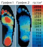 График распределения нагрузки обуви терапевтической Сурсил-орто / Sursil-ortho, после хирургических вмешательств на заднем отделе стопы, легкой 09-110