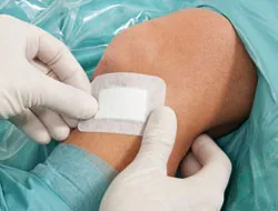 Повязка Космопор Антибактериал (Cosmopor Antibacterial) послеоперационная самоклеящаяся с серебром размером 10х6см в упаковке 25шт, 901001