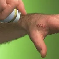 Повязка аэрозольная Opsite Spray (Опсайт спрей) пленочная прозрачная водостойкая, 1шт