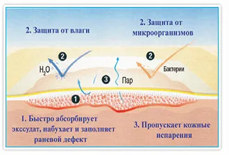 Повязка Suprasorb P на крестец самоклеящаяся полиуретановая губчатая, 18х20см, 5шт, 20415