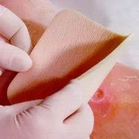 Повязка губчатая Allevyn Non Adhesive с антибактериальным действием, не прилипает к ране, 40х70см, 2шт, 66000663