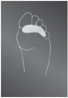 Подкладка опорно-корригирующая Protect Toe cushion силиконовая для защиты от давления, K643