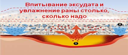 Повязка Suprasorb X (Супрасорб Х) регулирует гидробаланс неинфицированных ран и заживляет, 14х20см, 20532