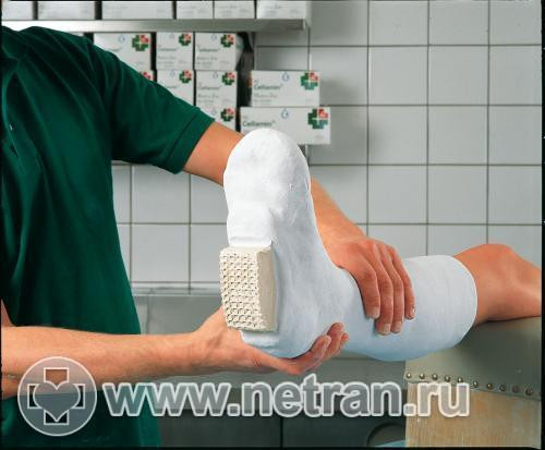 Каблук Целлона для использования при наложении иммобилизирующей повязки, размер большой, антискользящий протектор, 50822