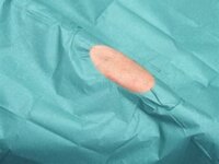 Простыня хирургическая BARRIER с отверстием 6х8 см, адгезивная, стерильная, размер 50х60 см, 75 шт в уп., 906693