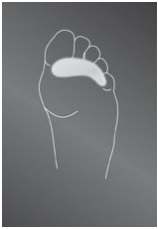 Подкладка опорно-корригирующая Protect Toe cushion силиконовая для защиты от давления, K643