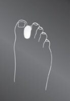 Корректор межпальцевой Protect toe spreader силиконовый для защиты от воспалений и мозолей, K644-0