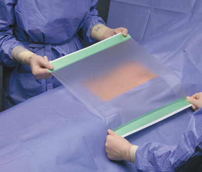 Пленка инцизная хирургическая Opsite Incise для защиты операционной раны, надежная фиксация к коже, 14х25см, 20шт, 4967