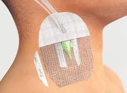 Плівкова пов'язка Opsite I. V. 3000 1-Hand для периферичних і центральних катетерів, стерильна, 12х9см, 50шт, 66004009