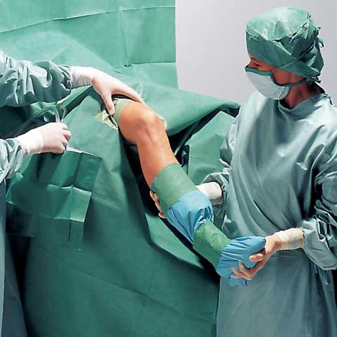 Стерильное хирургическое белье. Комплект хирургический стерильный для артроскопии. Комплект белья для артроскопии коленного сустава. Стерильное белье операционное.