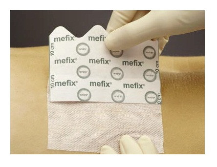 Пластырь фиксирующий Mefix для фиксации катетеров, повязок и тампонов, в рулоне 30см х10м, 313000