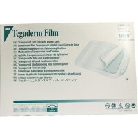 Пластырь Tegaderm Film 3M прозрачный водостойкий для катетеров и закрытия ран 15х20см, 1628