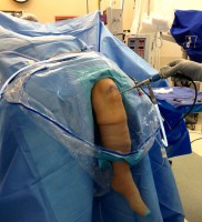 Мешок для коленной артроскопии BARRIER, 2 круглых мембраны для конечностей, стерильный, 60х120см, 12 шт, 69200