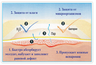 Повязка губчатая Suprasorb P (Супрасорб П) полиуретановая самоклеящаяся для заживления ран, 15х15см, 5шт, 20418