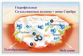 Повязка Супрасорб A+Ag кальциево-альгинатная с ионами серебра, 10х10см, 20571