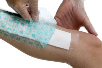 Післяопераційна пов'язка Opsite Post-Op плівкова з всмоктуючою неприлипаючою прокладкою, 12х10см, 10шт, 66000710