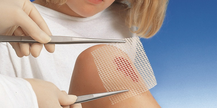 Повязка Grassolind (Гразолинд) мазевая без фармпрепаратов для ран, стерильная, 20х20см, 10 шт., 4993153