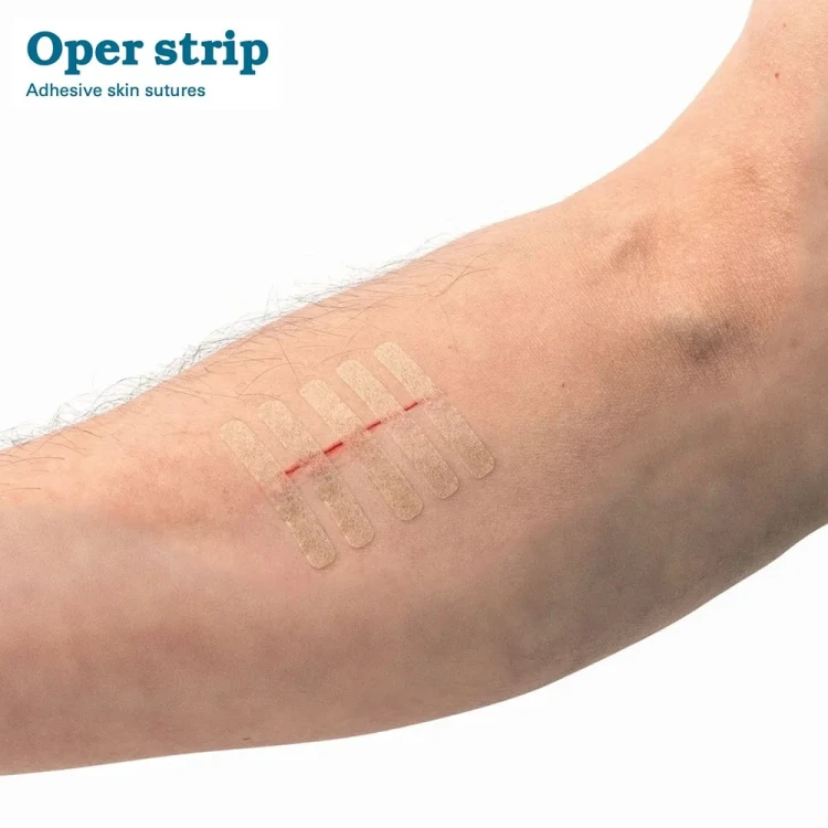 Полоски пластырные Опер Стрип (Oper Strip) гипоаллергенные стерильные 25х125мм, 0037805